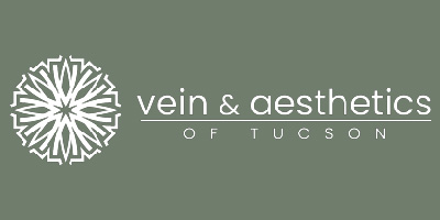 vein and aesthethics